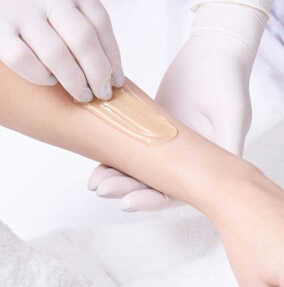 laser treatment to help with scars